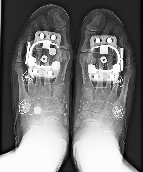Cycling Shoe X-Ray