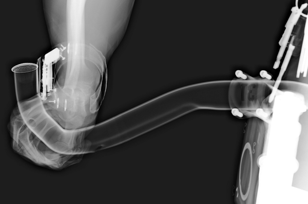 Road Cycling Handelbar X-Ray