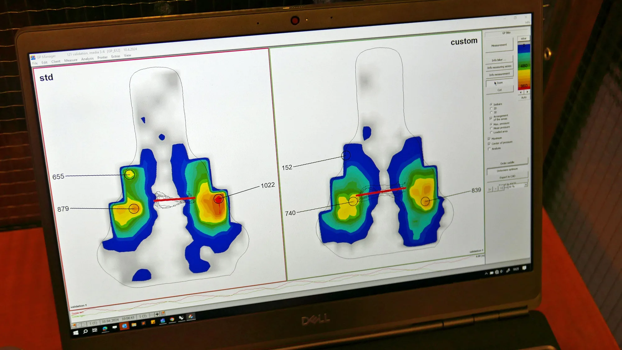 Physicist one-one adaptive special 3D printed carbon bike saddle, Cory's asymmetric pressure map