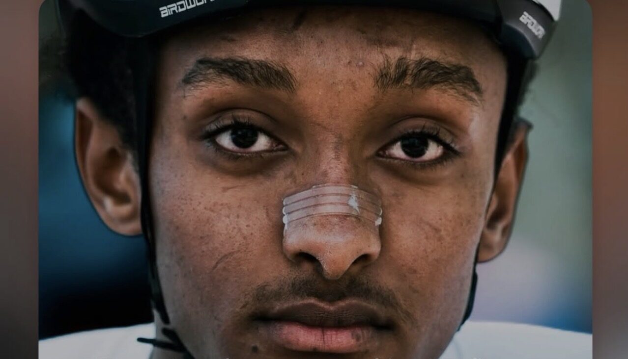 19-Year-Old USCX Champion Tofik Beshir in ICU After Vehicle Strikes Him on Training Ride